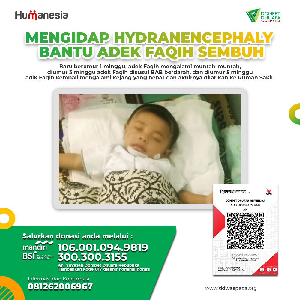 Mengidap Hydranencephaly Adek Faqih Sembuh