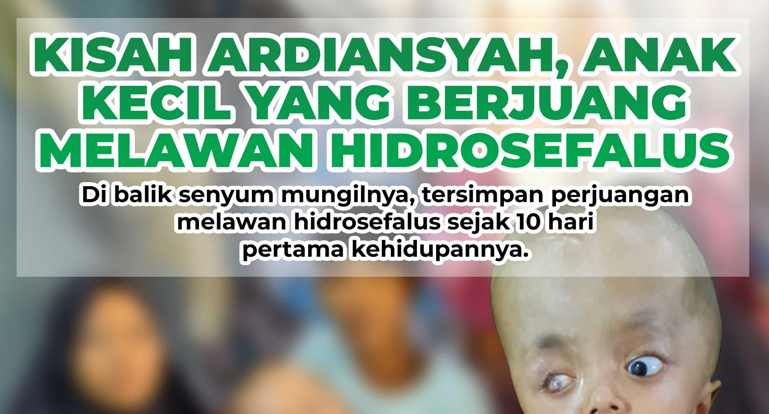 Ardiansyah Putra, Pejuang Kecil Hidrosefalus dari Merbau